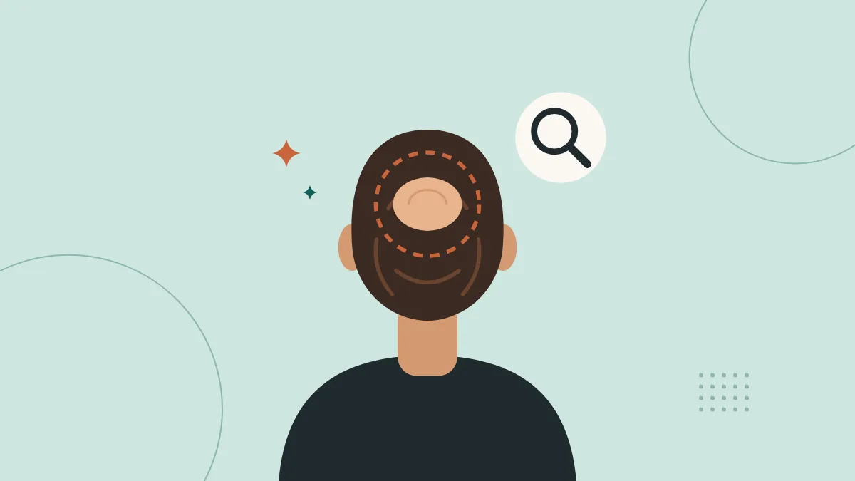 Illustration: How to Hide a Bald Spot on the Crown: 9 Easy Ways That Work