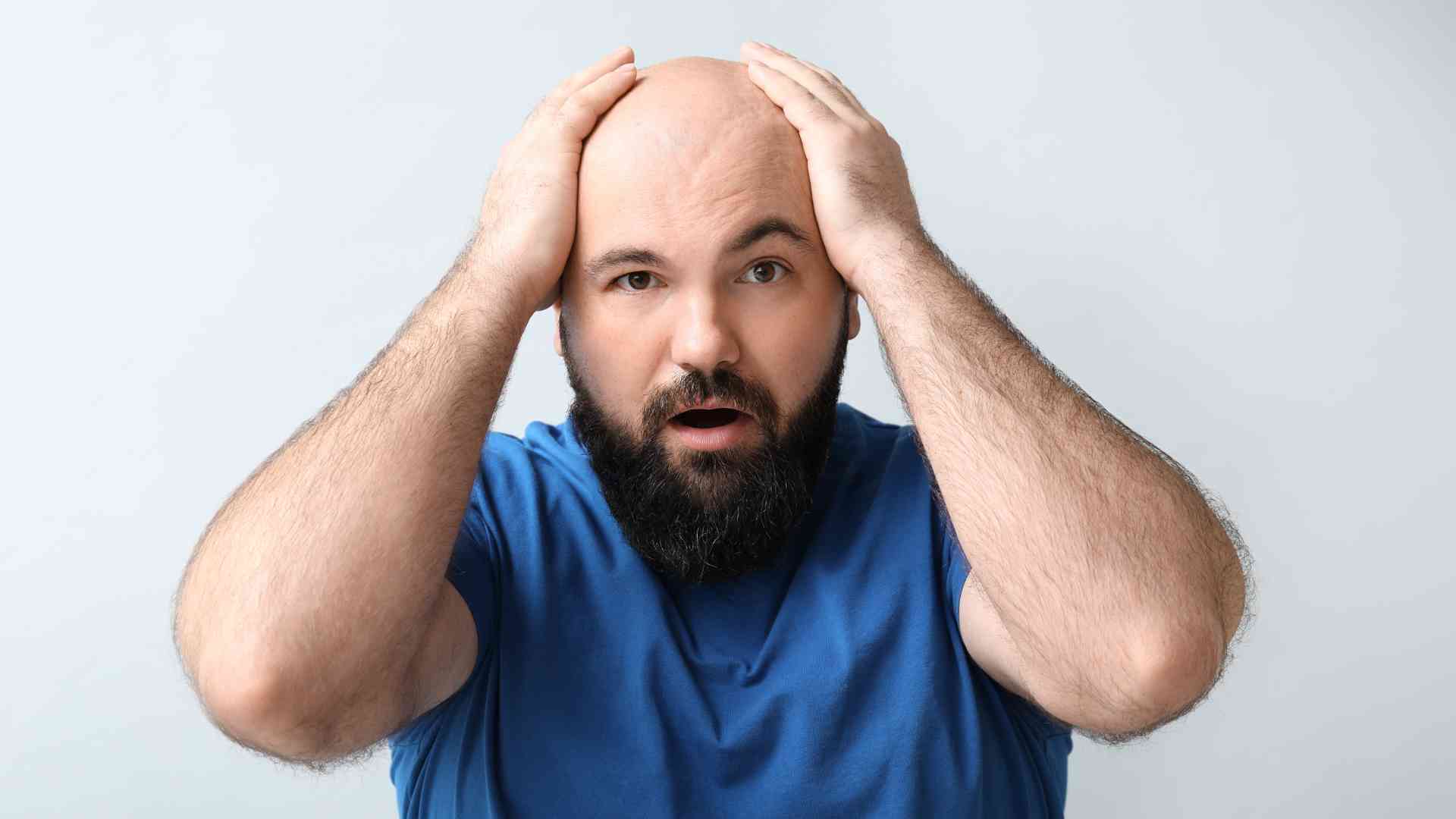 can genetic hair loss be stopped