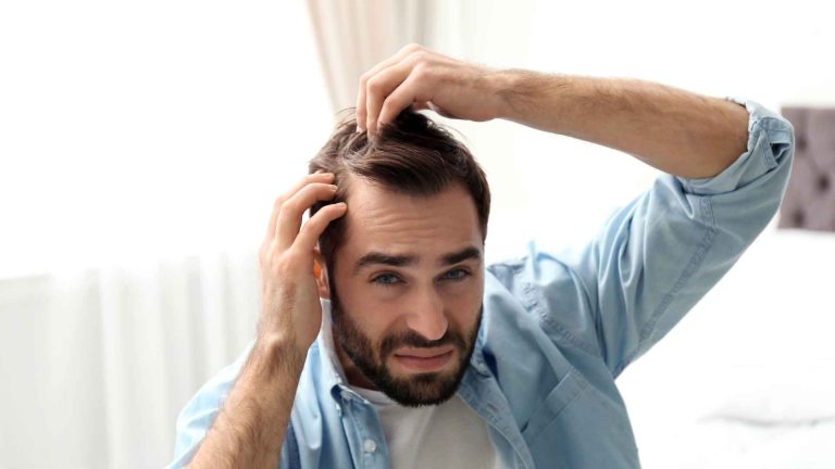 When Does Hair Loss Start: Early Signs of Balding Guide