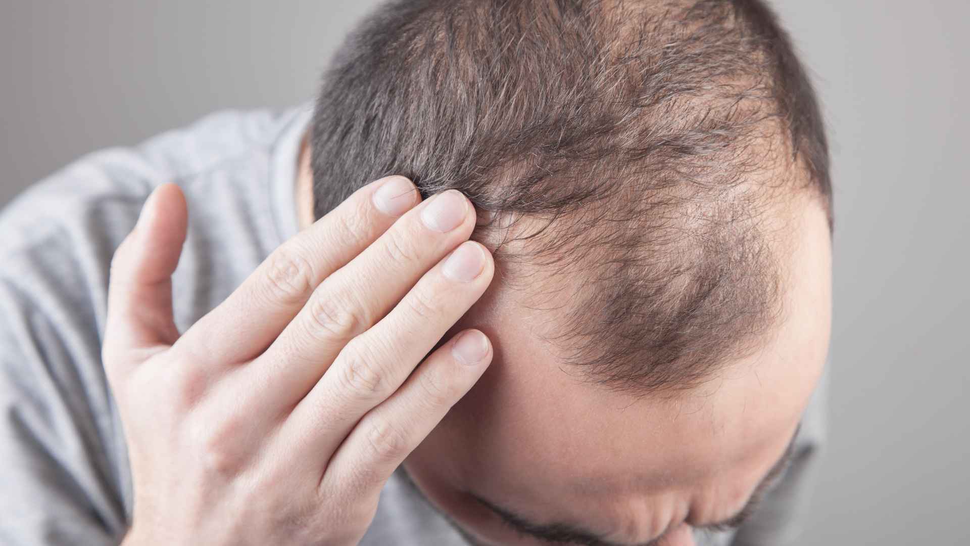 Does Creatine Cause Hair Loss? Debunking the Myths Guide