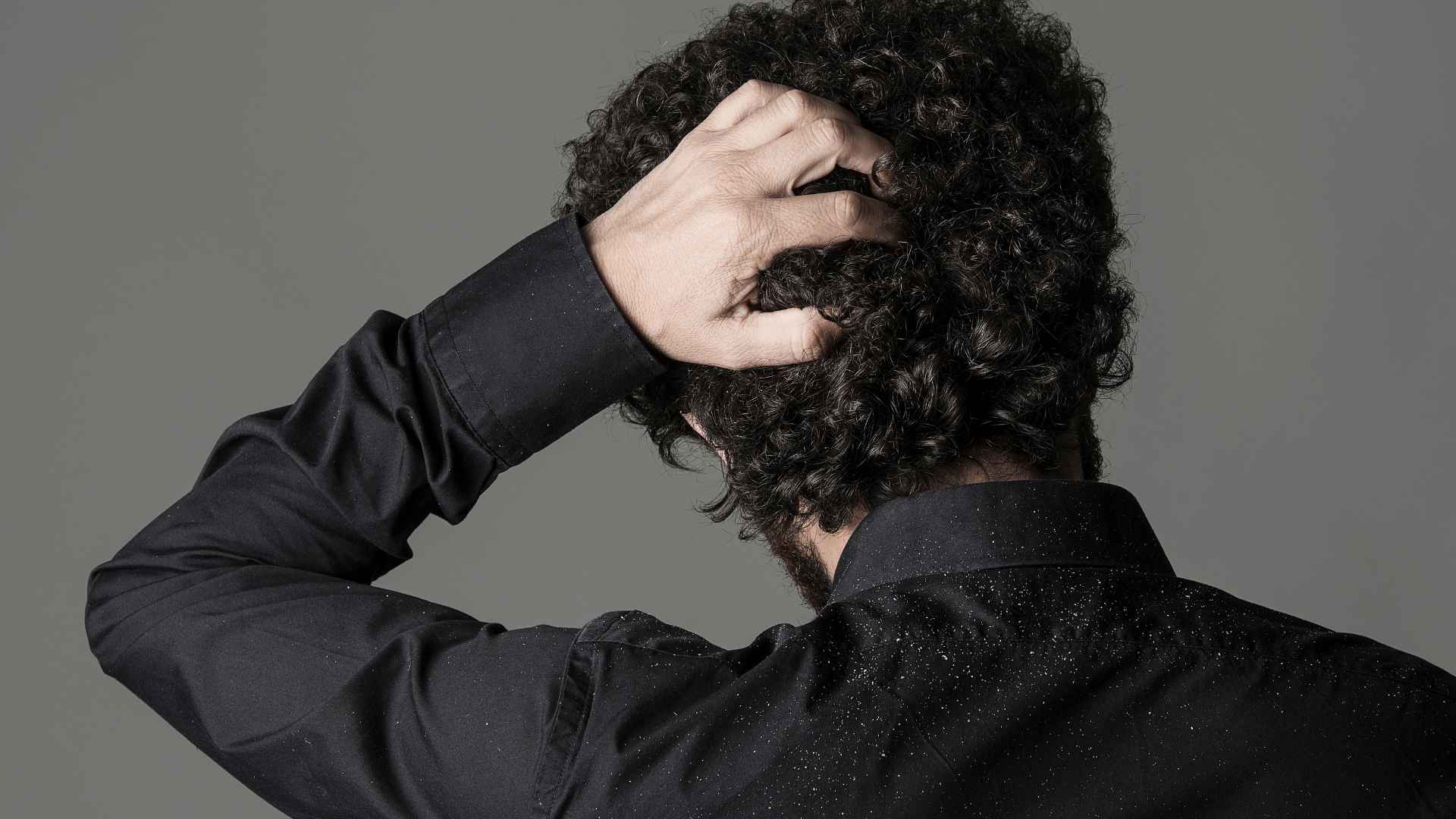 Can Dandruff Lead to Hair Loss? Debunking the Myth Guide