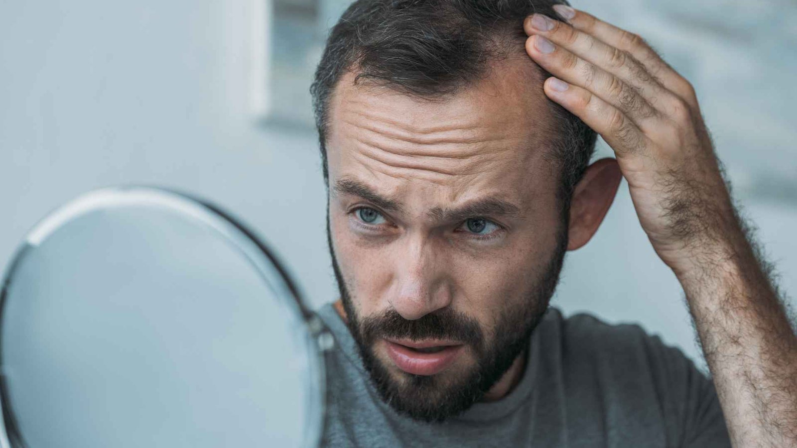 does smoking cause hair loss