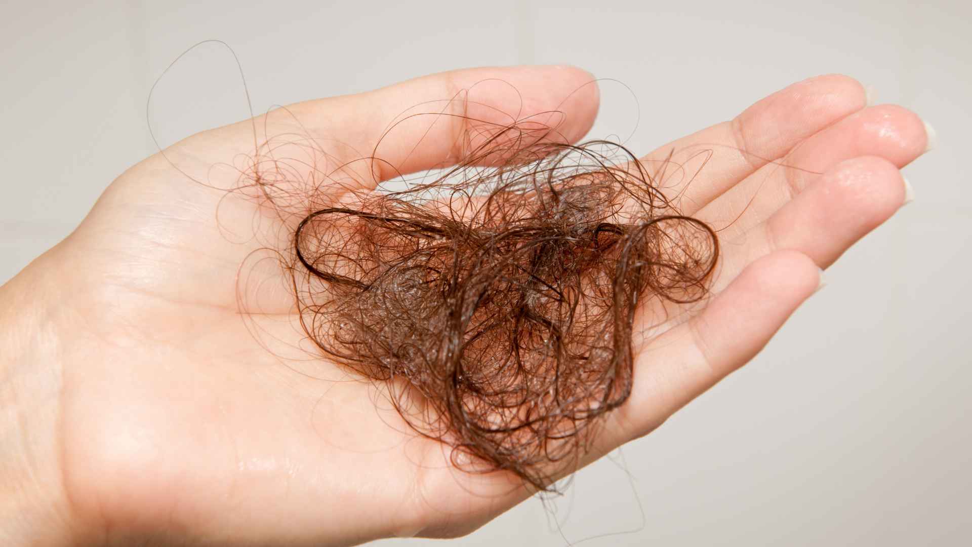 how much hair loss is normal