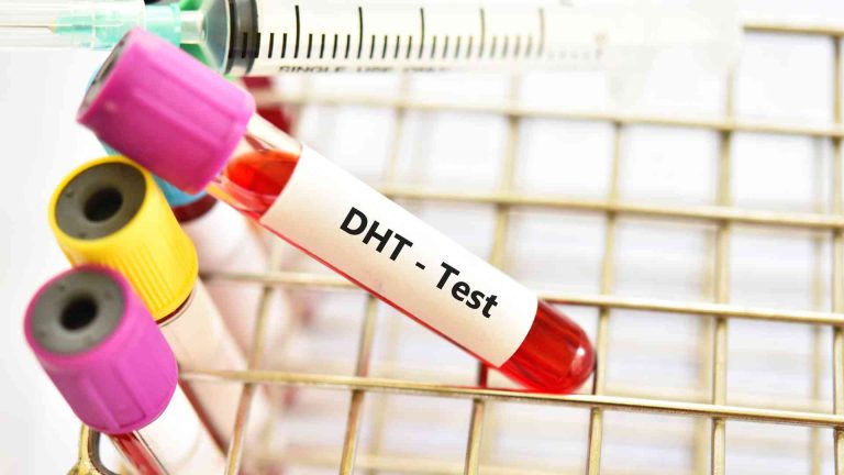 Can DHT Hair Loss Be Reversed? Treatments Guide