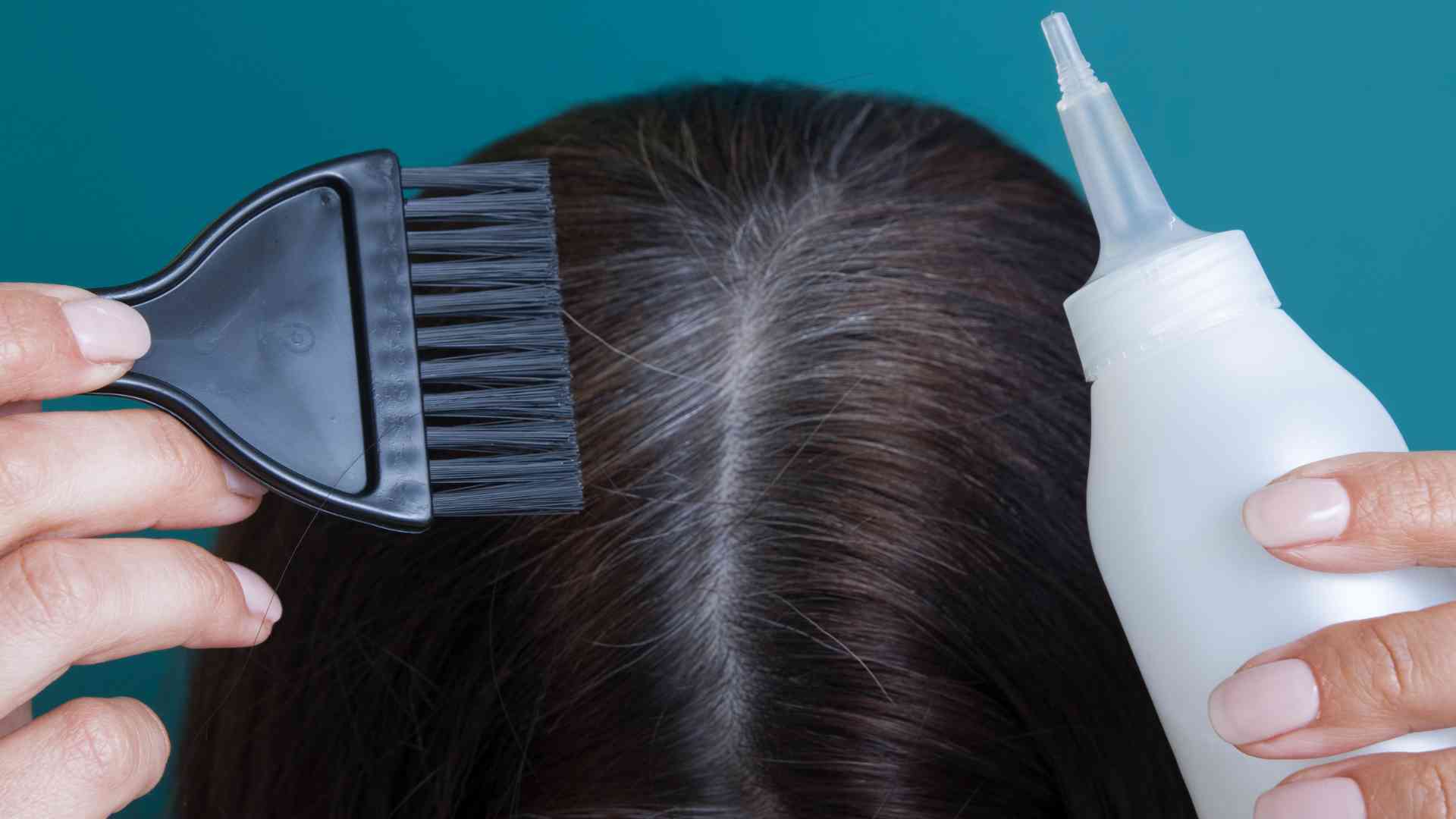 Can you explain the connection between hormonal changes and hair loss