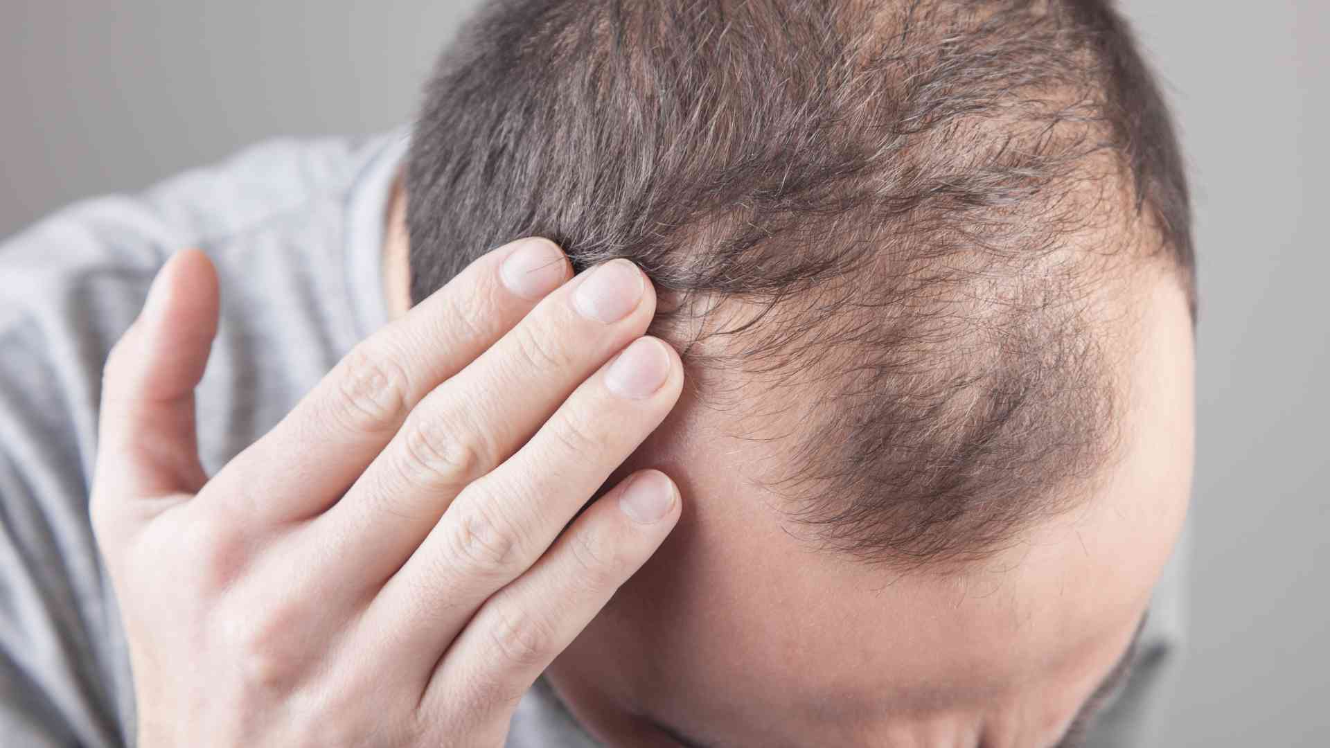 What are some overlooked environmental factors that contribute to hair loss