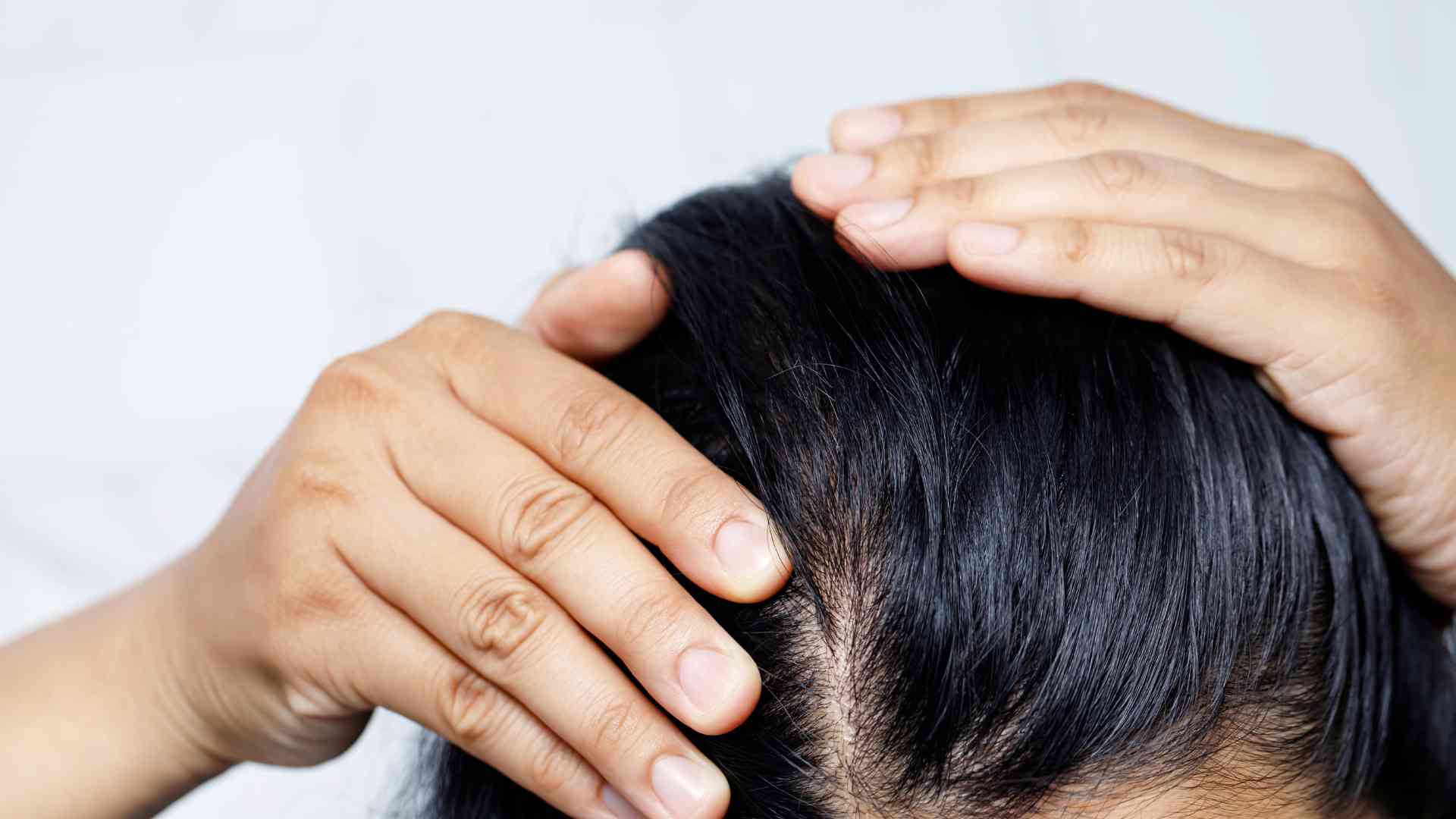 can eating too much protein cause hair loss