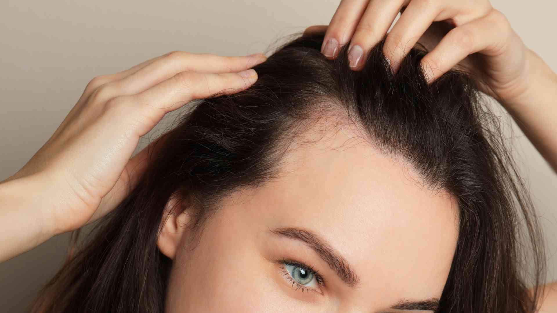 What role does scalp health play in preventing hair loss