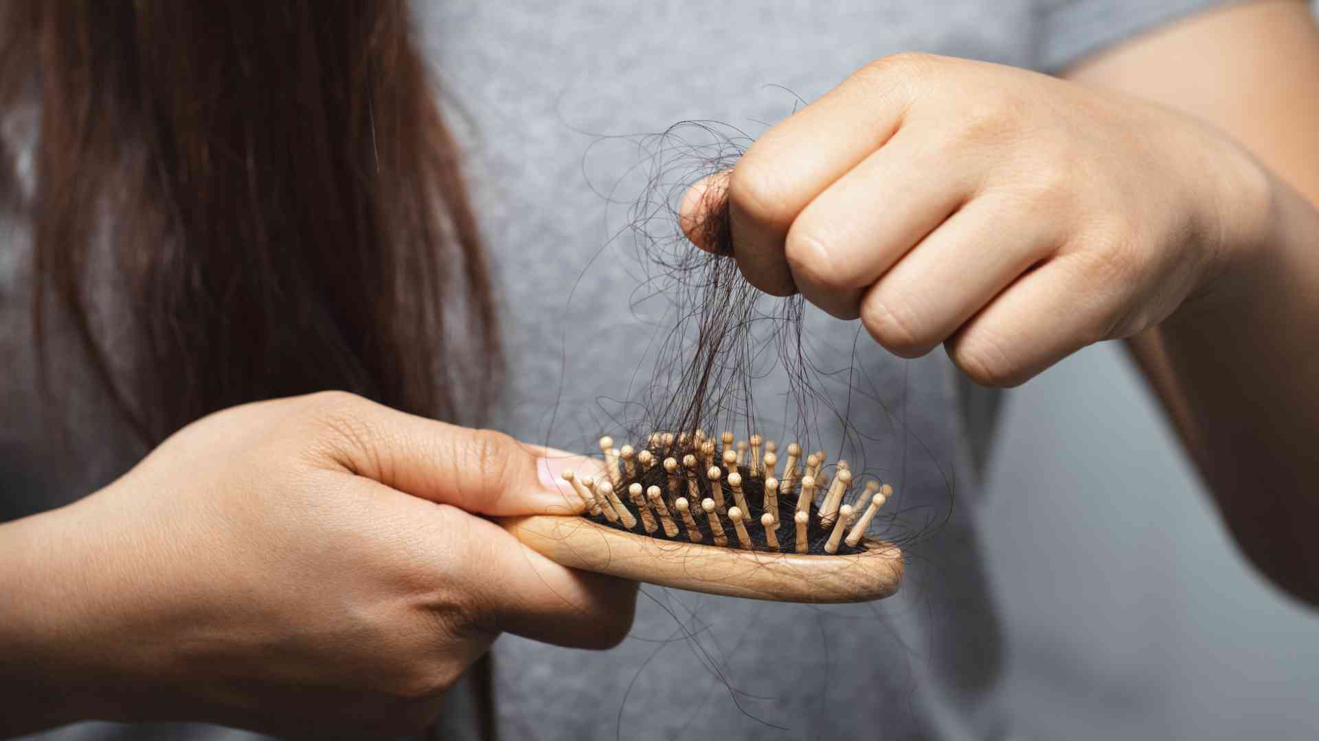 Can Hair Loss Symptom of Underlying Medical Condition?