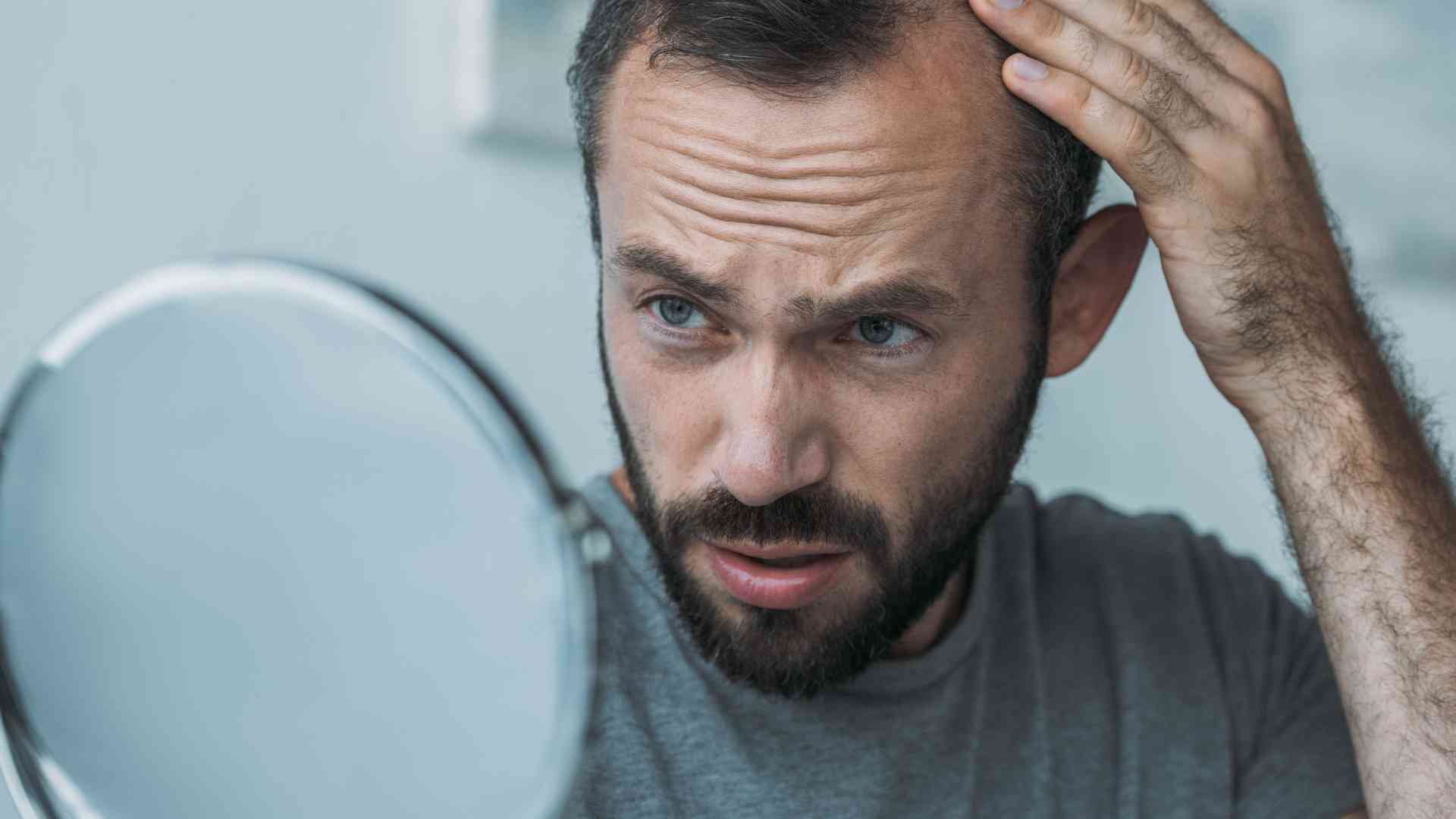 Are Brazil Nuts Good For Hair Loss And Thinning Guide 360hairloss