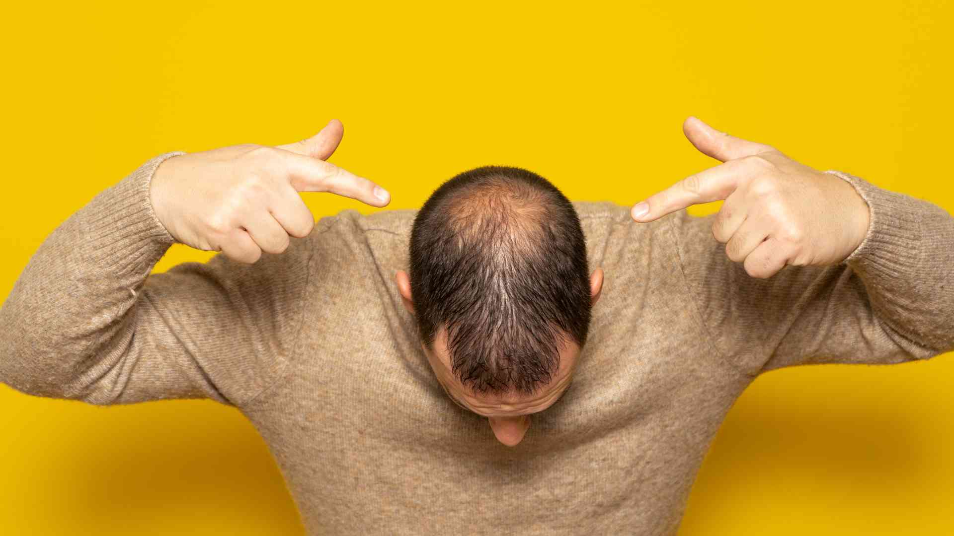 can age cause hair loss