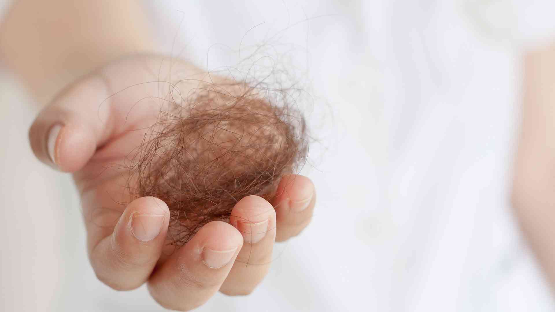 can change in weather cause hair loss