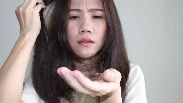8 Lesser-Known Factors That Contribute to Hair Loss in Women