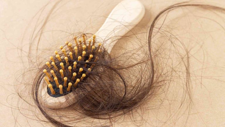 What Is Traction Alopecia and What Causes It?