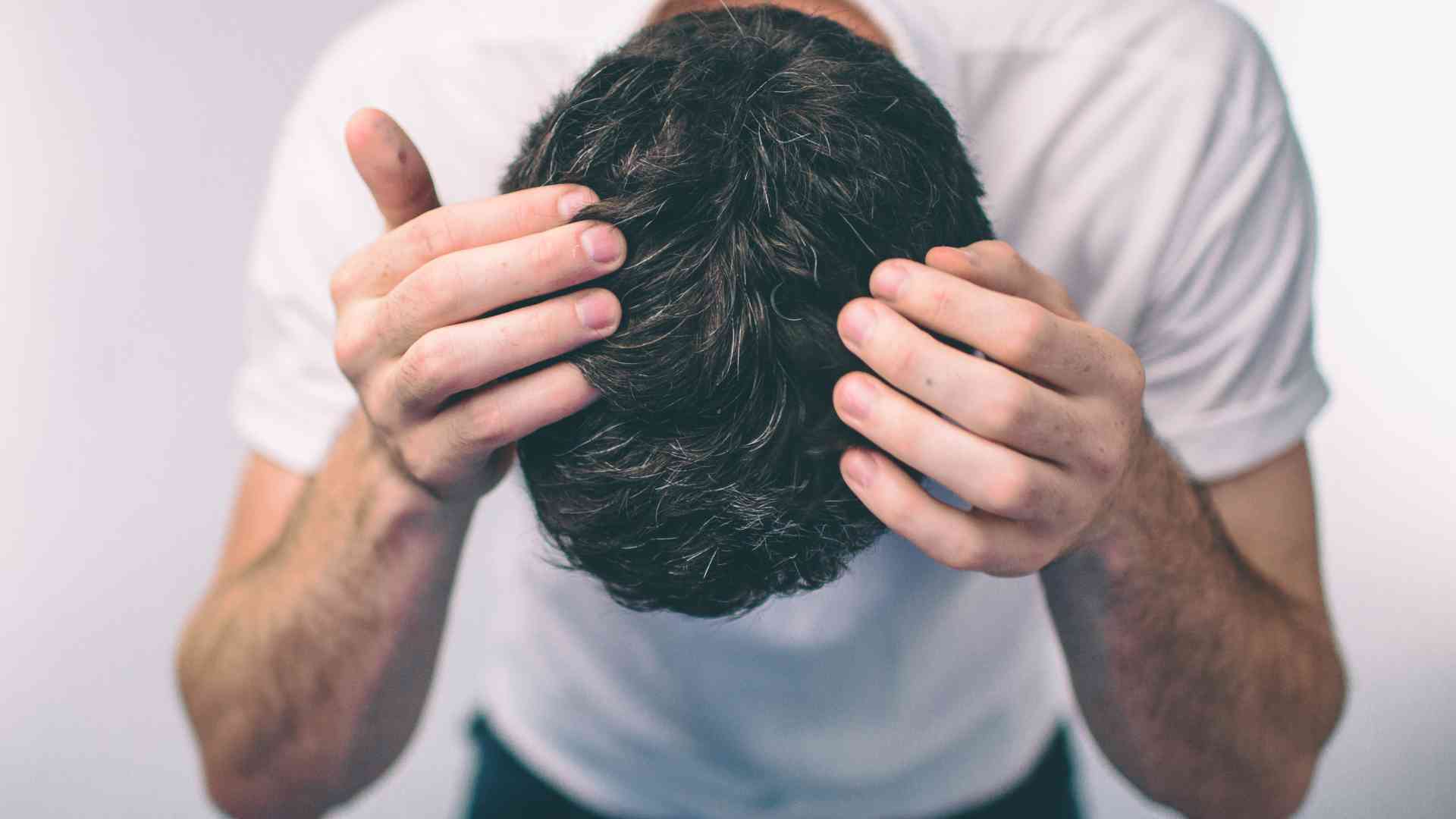 can dht hair loss be reversed