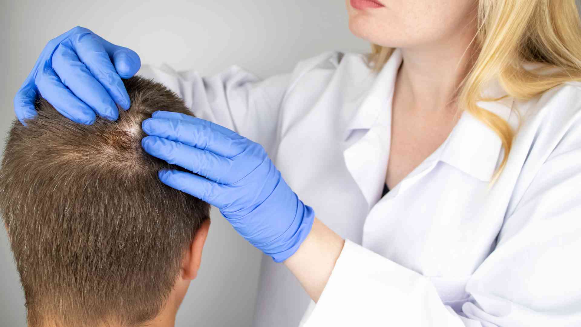 can you get tested for hair loss