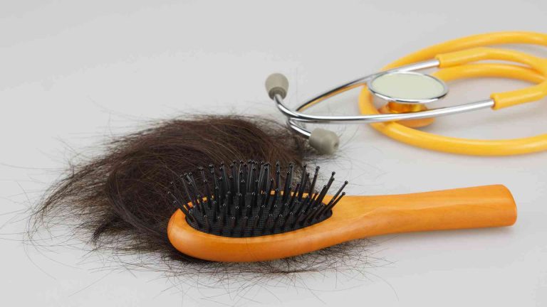 What Is Connection Between Hormonal Changes and Hair Loss?