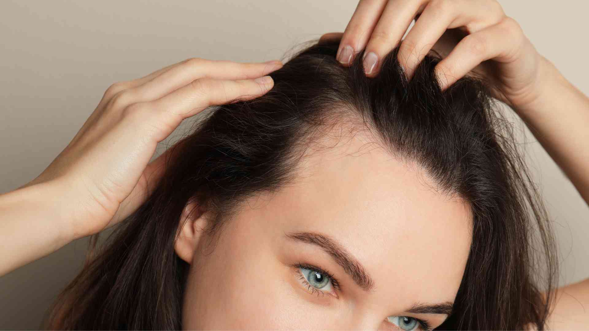 What is traction alopecia and what causes it
